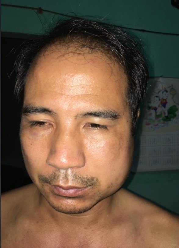 VỤ ÁN “CHỐNG NGƯỜI THI HÀNH CÔNG VỤ” Ở XÃ BÌNH PHÚ, THẠCH THẤT